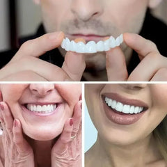 SMILEFIT PRO – ÁLLÍTHATÓ FOGPÓTLÁS KÉSZLET A TÖKÉLETES MOSOLYÉRT